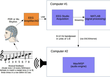 Encephalophone block diagram